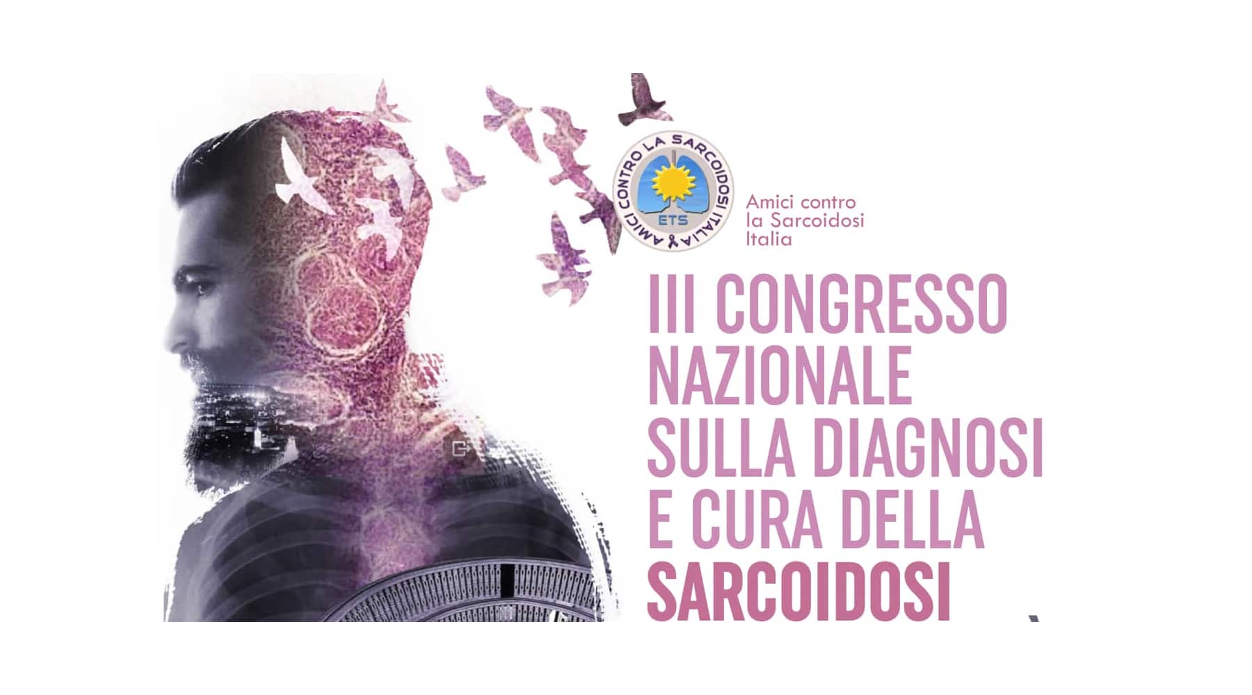 Clicca per accedere all'articolo III° Congresso nazionale sulla diagnosi e cura della Sarcoidosi - Padova, 19-20 aprile 2024